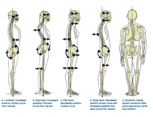 How Long Does It Take to Correct Posture with Pilates?