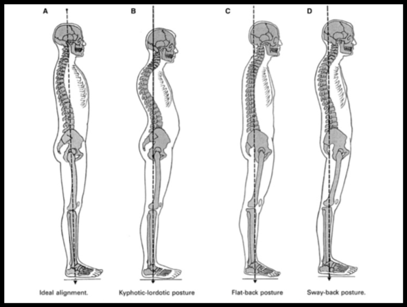 Proper Form and Posture in Exercise: Pilates Classes That Build Strength